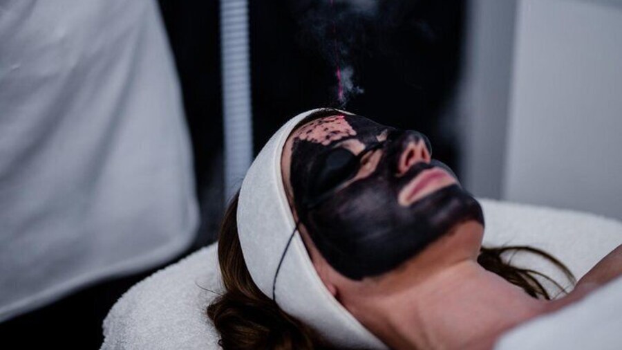 Spectral Peeling Laser Black doll in Bemerode