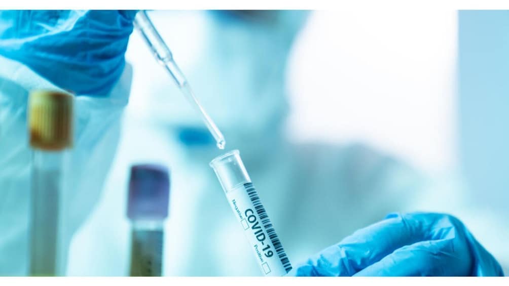Covid19 RT- PCR Test with Separate Fit to Fly Certificate