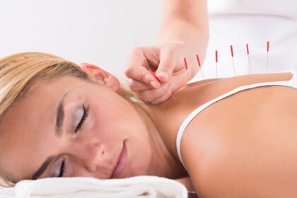 Traditional Japanese Acupuncture Treatment